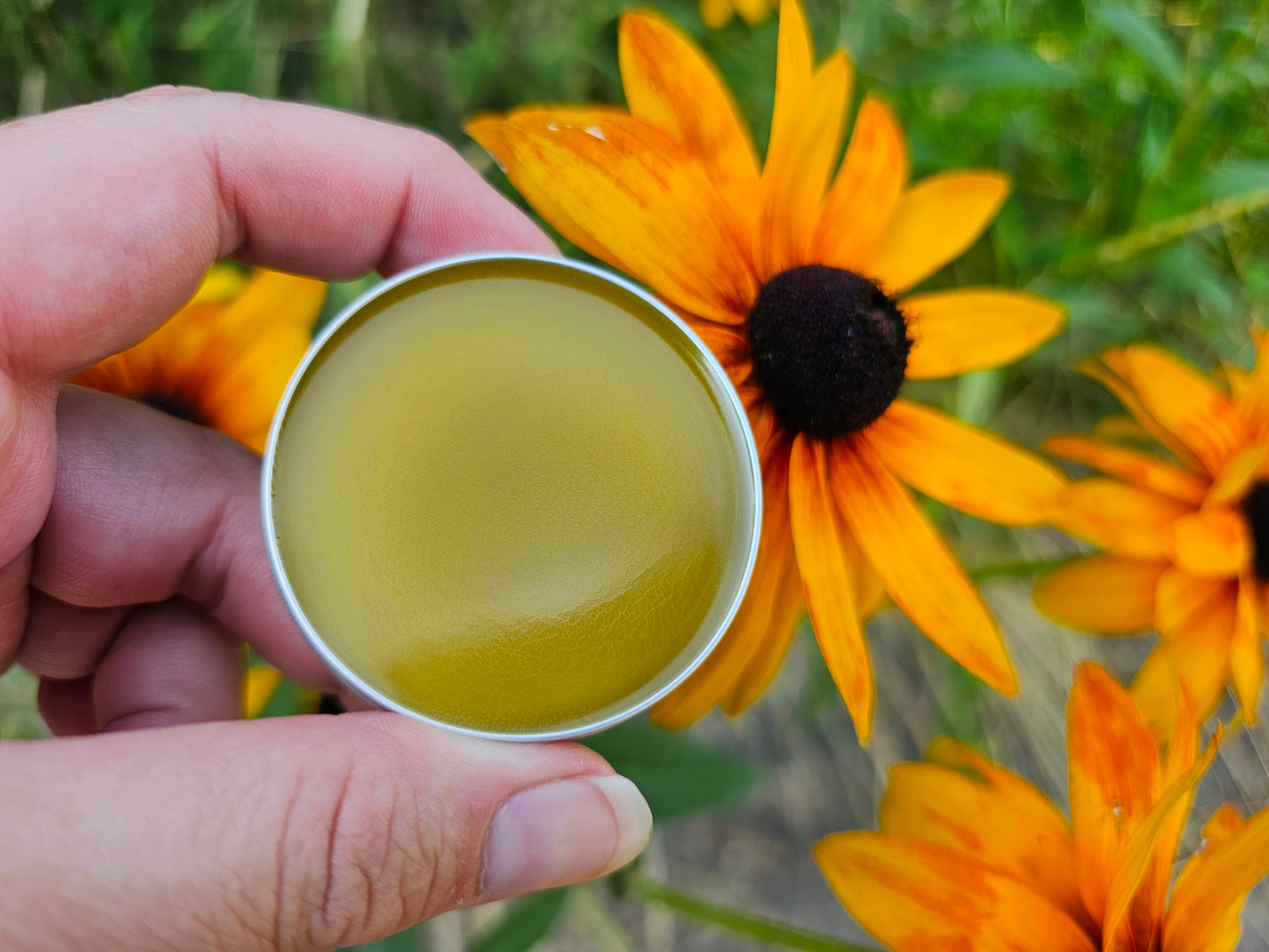 Eczema Rough scaly dry skin patch Balm for sensitive skin